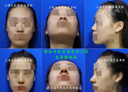 上海最有名气的鼻王是哪位医生？