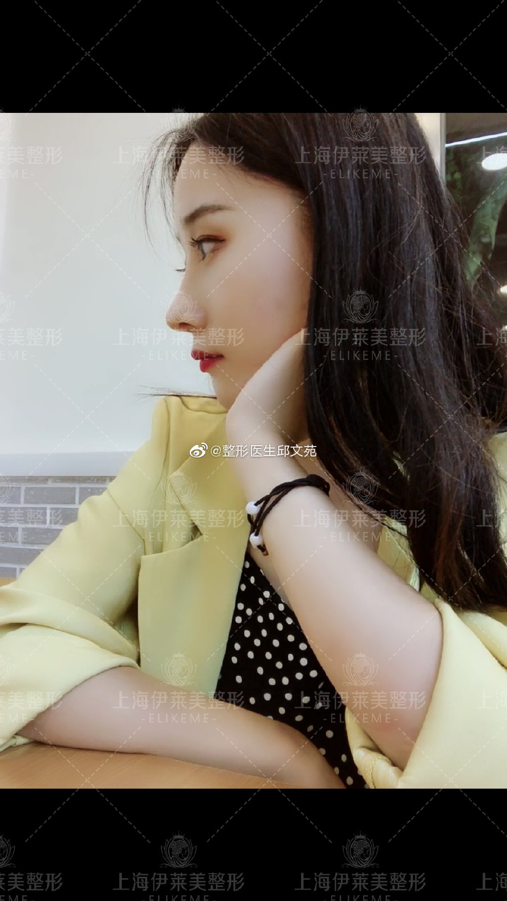 上海最有名气的鼻王是哪位医生？