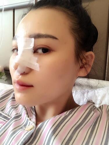 中国很难预约十大隆鼻专家