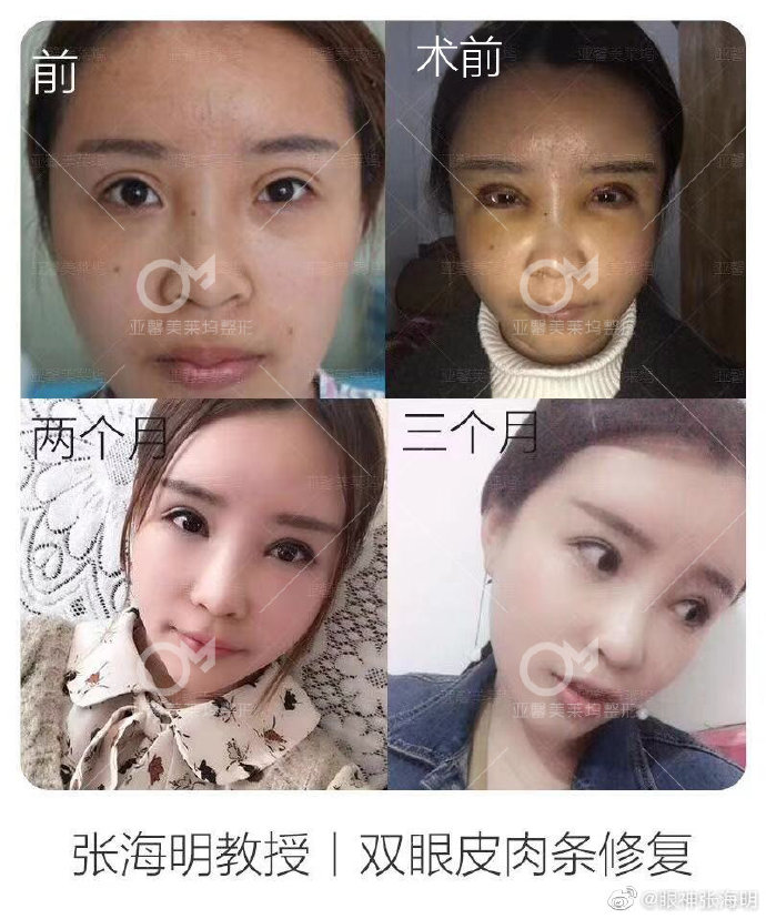 北京眼修复王振军与张海明谁修复的好？
