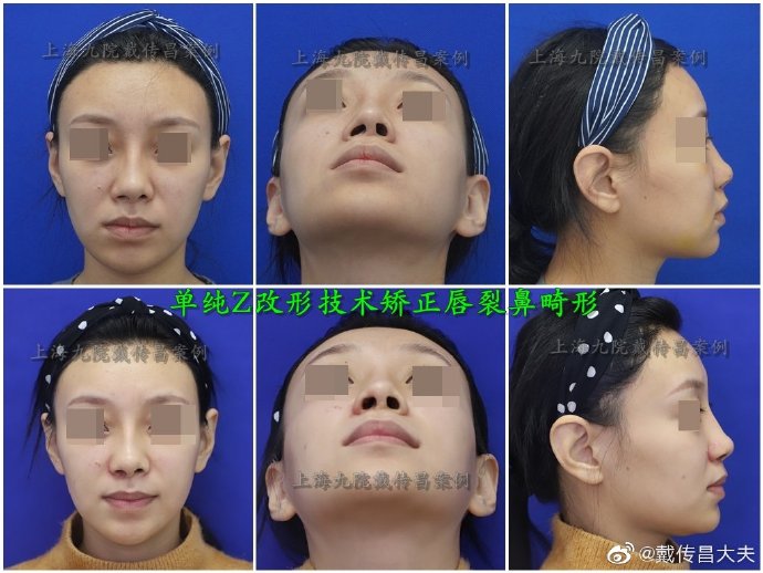 刘彦军和戴传昌哪个技术好？