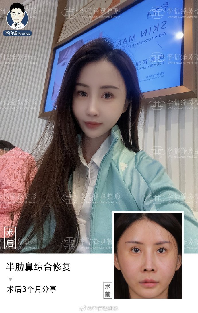李信锋