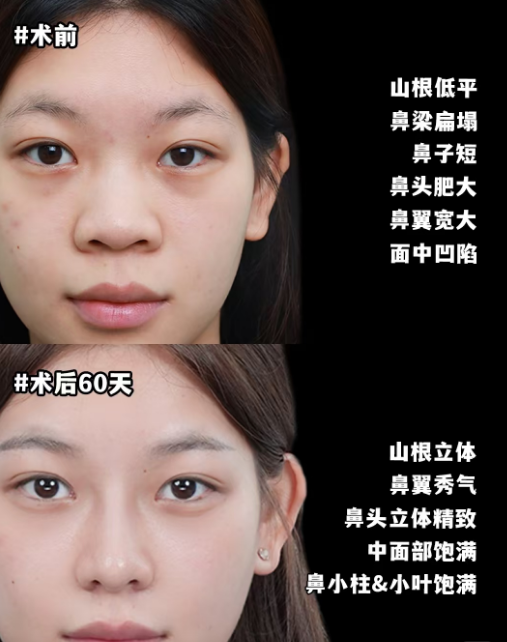 2026年上海鼻修复做的最好的医生是哪个？戴传昌、范荣杰、李章？