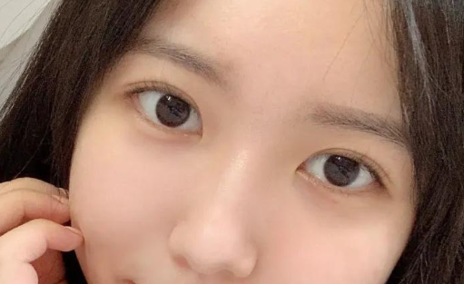 北京做双眼皮最火最好的医生是哪个？张大艳、臧荟然、姬东硕、黄久佐、李燕