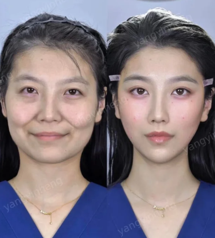 杨胤恒馒化修复案例