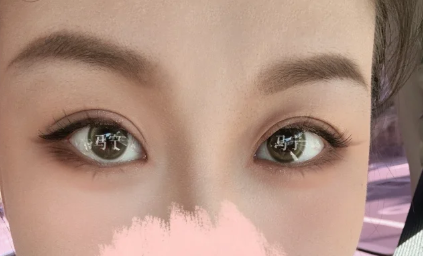 北京八大处双眼皮医生推荐哪个?马宁、梁雪冰、卢建建?