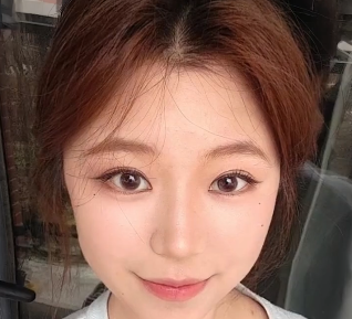 李瑞萱双眼皮案例