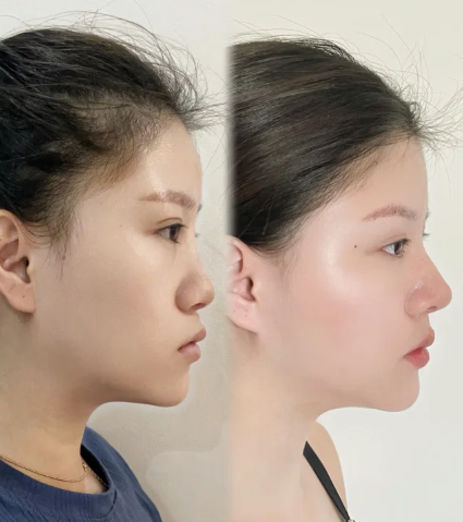 沈阳鼻整形范东良和李继森哪个医生口碑好?