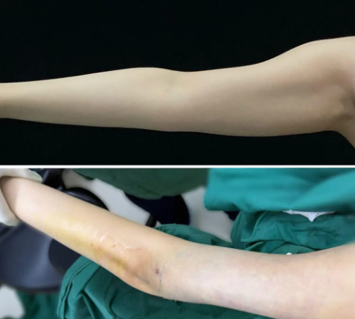 沈阳吸脂哪个医生好?冷冰、王晨超、王迪