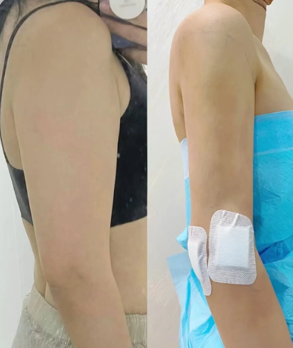 大连吸脂医生哪个好?康乐和郑妍丽?