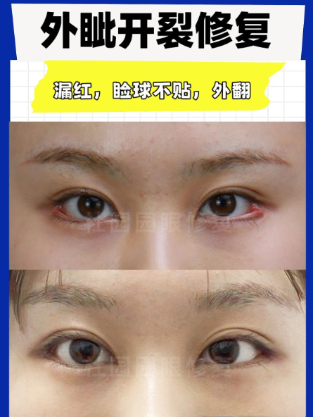 眼修复案例