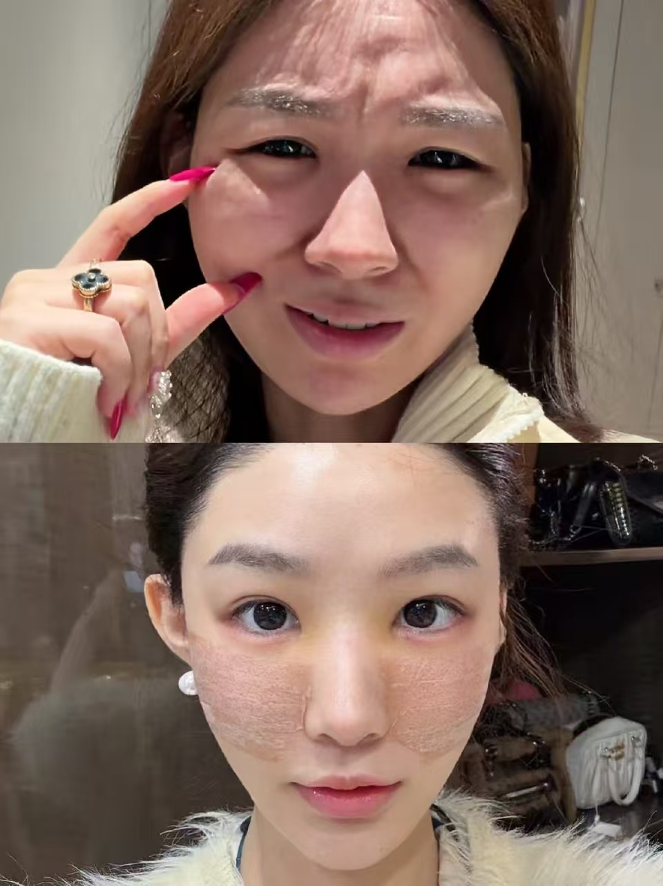 全国比较知名的馒化修复医生有哪些？吴贞跃、张本军、王阔远、陈向东？