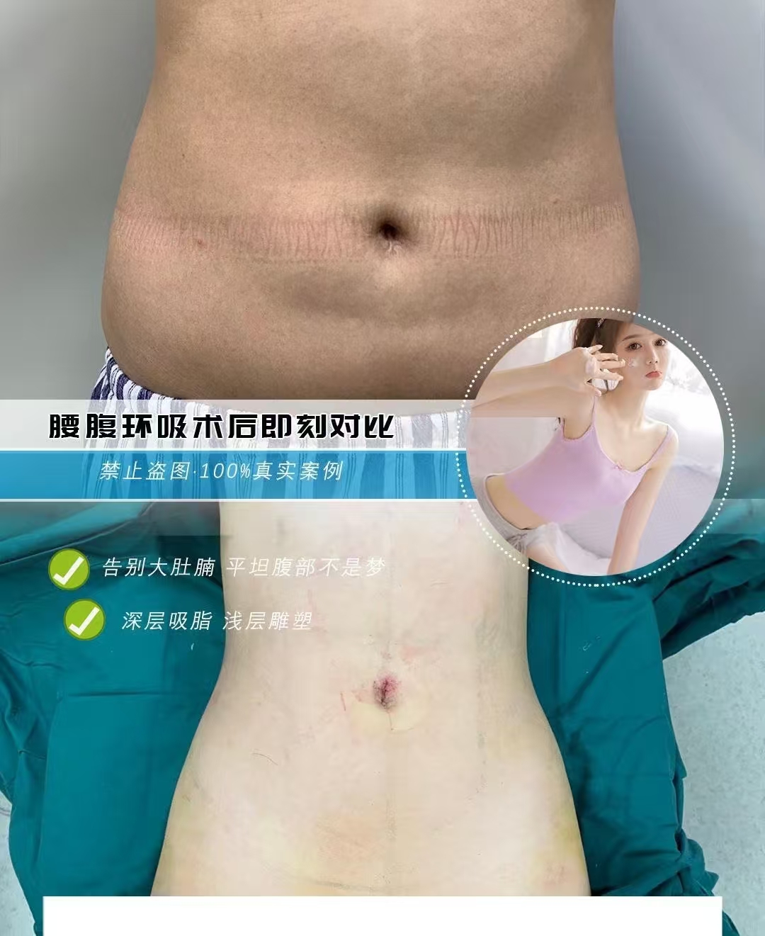 上海知名吸脂大咖都有哪些？曹卫刚和秦冬收费贵不贵？