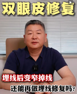 王剑双眼皮修复案例