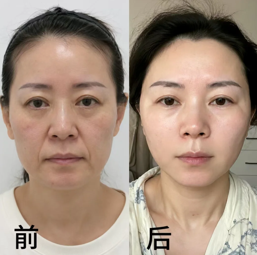 上海九院面部提升哪个医生好？张路和金云波哪个医生好？