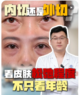 张锦松祛眼袋
