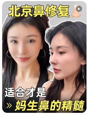宫风勇鼻修复