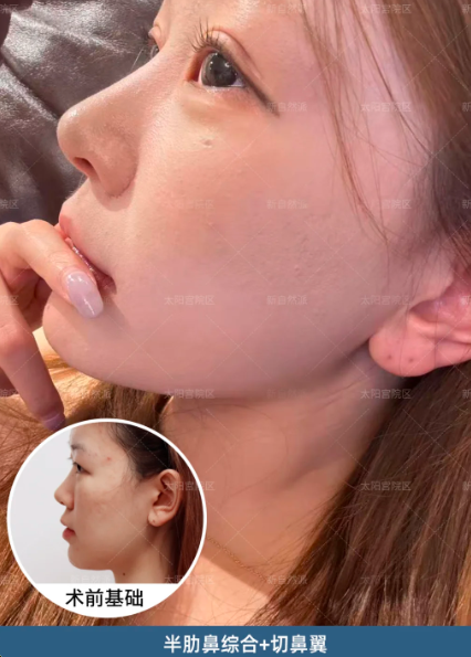 王彦驰鼻综合
