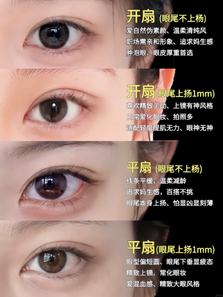 鞠孟然双眼皮案例