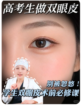 梁雪冰双眼皮