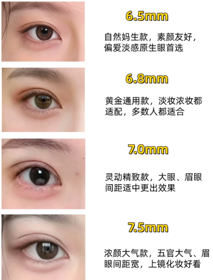 北京双眼皮