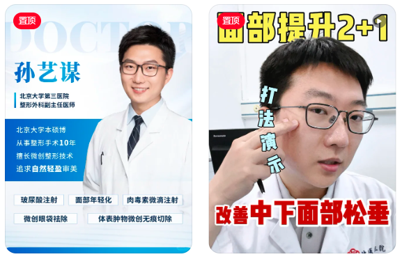 孙艺谋玻尿酸