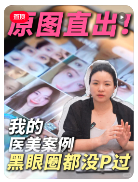 郝红梅双眼皮