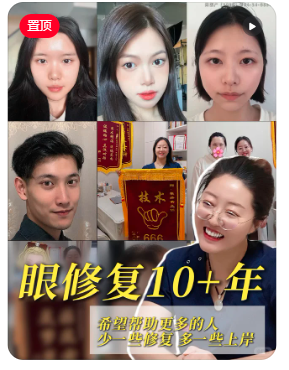 张诗若
