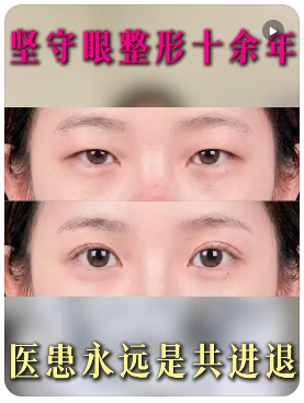 顾钏双眼皮