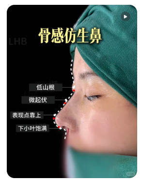 刘海波鼻综合
