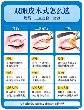双眼皮