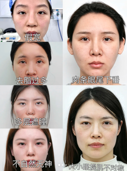 眼修复