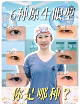 双眼皮