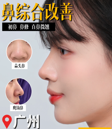 广州鼻综合