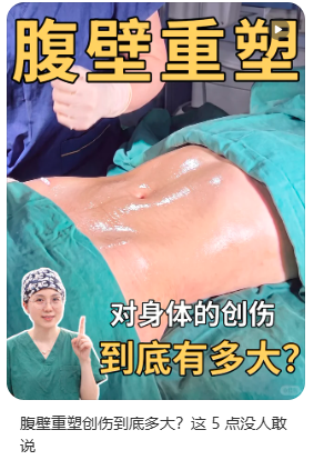腹壁年轻化