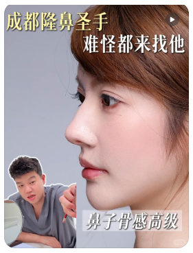 成都隆鼻专家谁更出名？李竞和周顺波哪个医生做修复好？