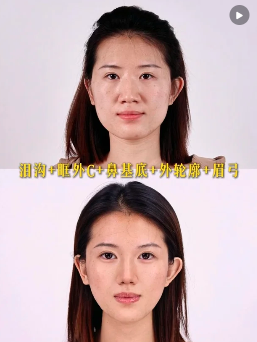 面部微雕
